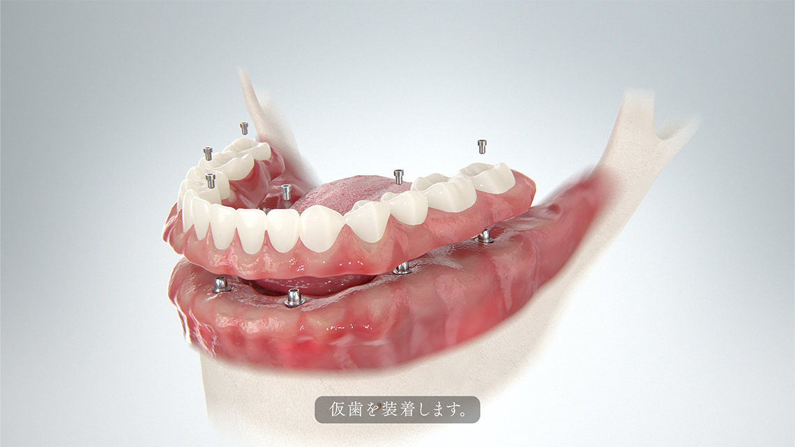 01_ADC_edit_0213_2_01753の画像